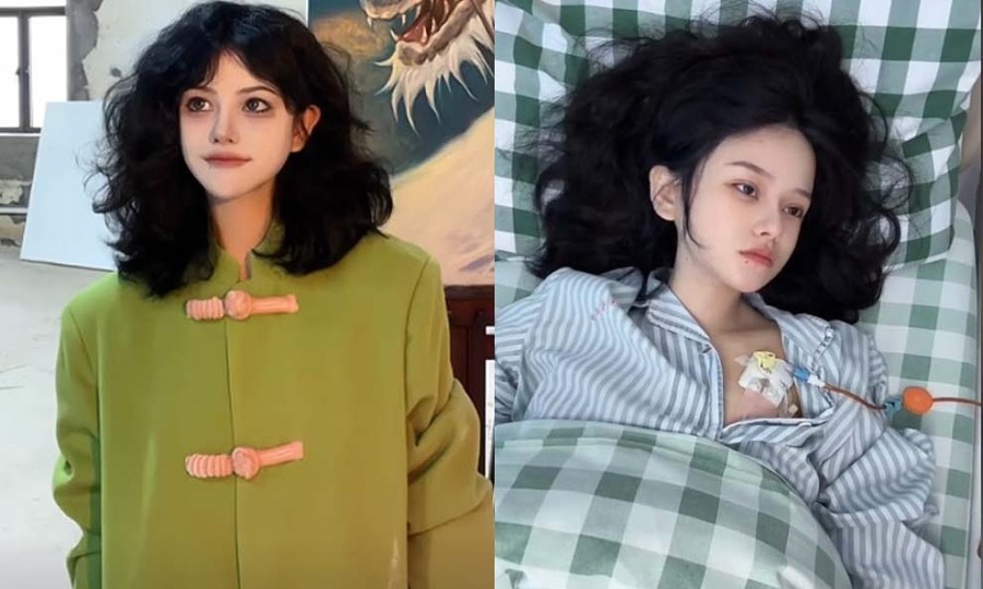 Phát hiện ung thư trực tràng giai đoạn cuối ở tuổi 24