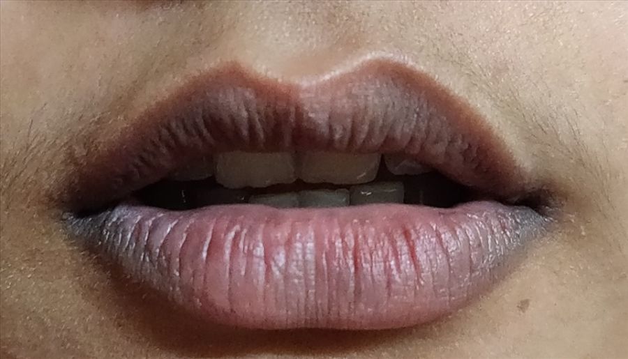 Ba vị trí cơ thể thâm đen báo hiệu thận yếu