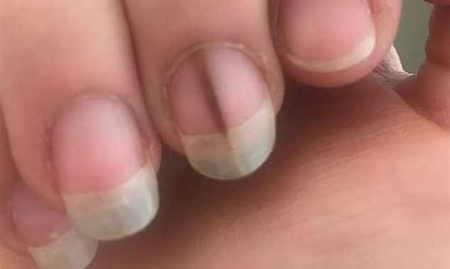 Ba lần tái phát ung thư của người phụ nữ