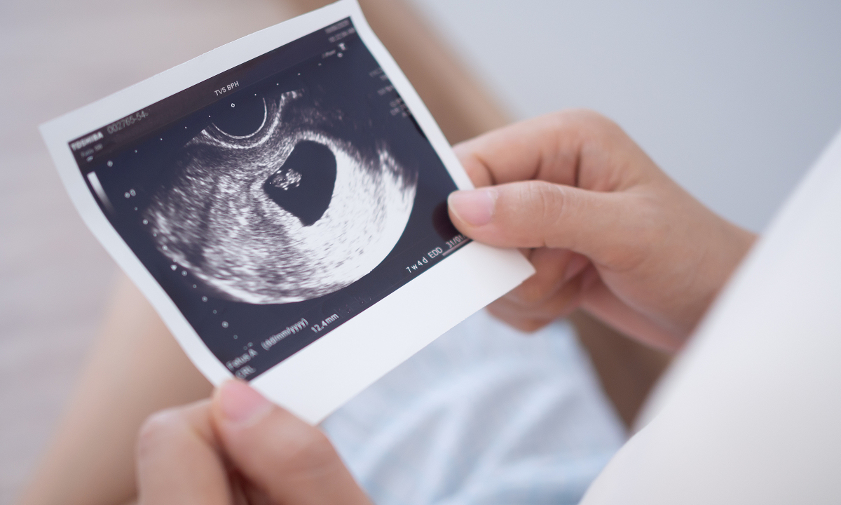 Tôi vừa tiêm cúm, phế cầu, có cần kiêng mang bầu?
