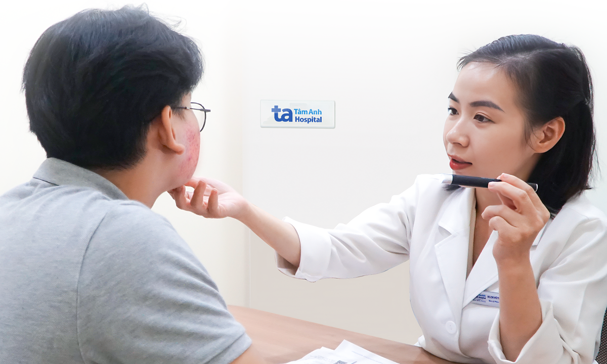 Bỏng da do bôi rượu thuốc trị mụn
