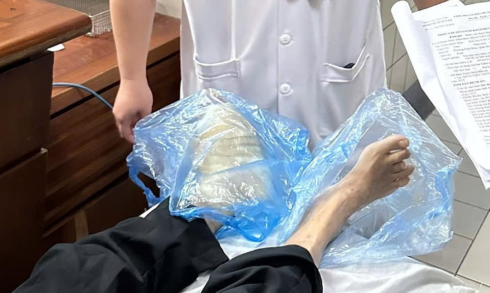 Loét chân do biến chứng tiểu đường