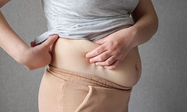 Ba vị trí tích mỡ bụng và cách loại bỏ
