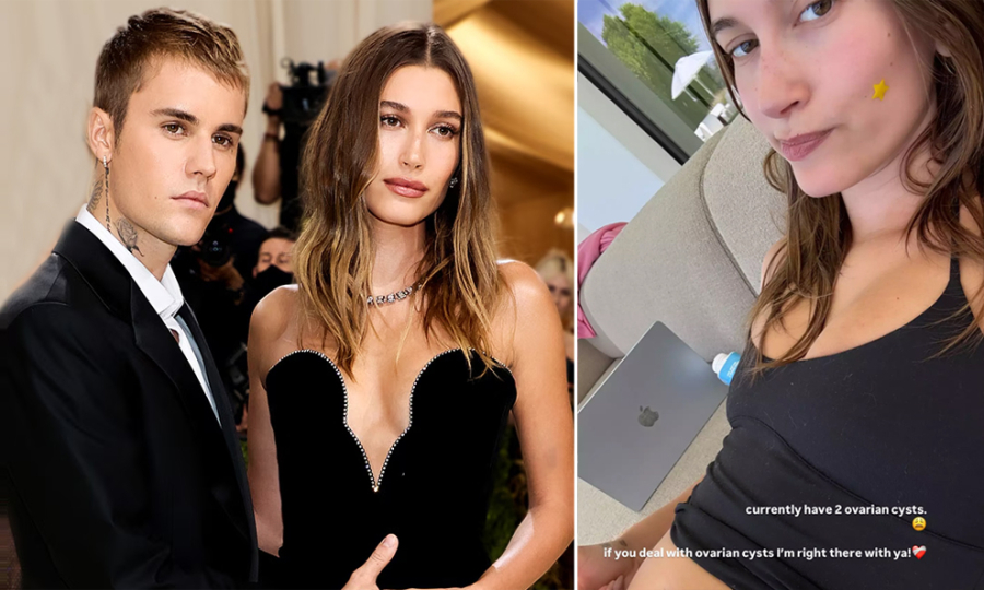 Vợ Justin Bieber tiết lộ mắc u nang buồng trứng