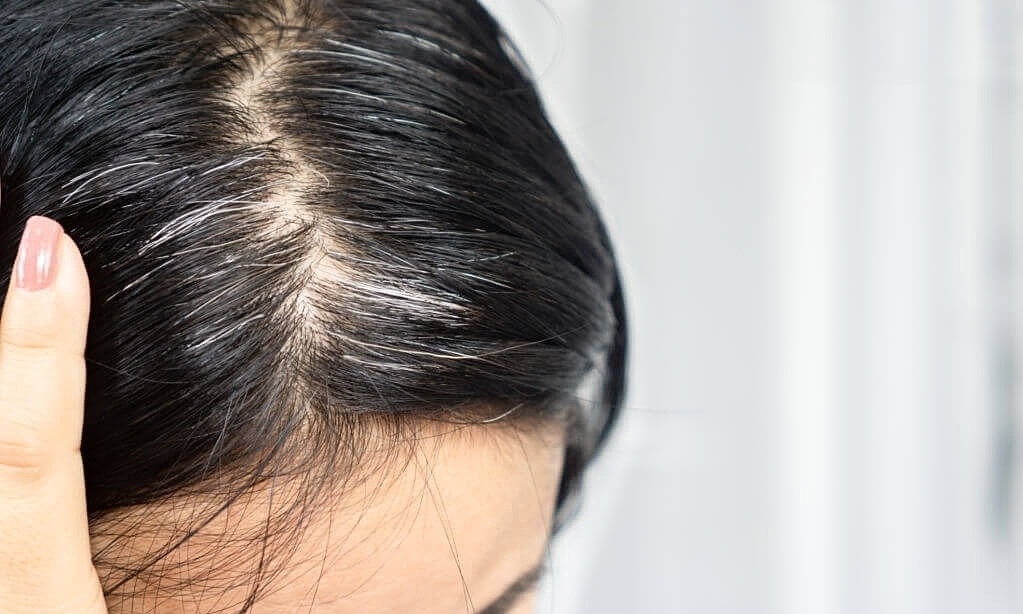 5 nhóm thực phẩm kìm hãm tóc đen chuyển bạc