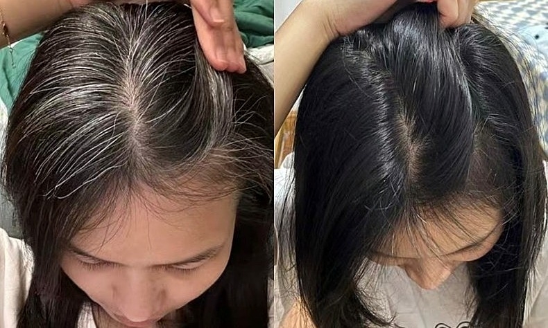 Có thể đảo ngược tóc bạc thành đen được không?