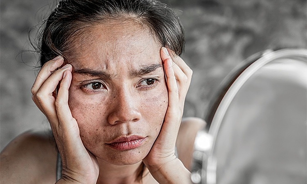 Làn da sau 30 lão hóa nhanh nếu thiếu 5 hoạt chất quan trọng