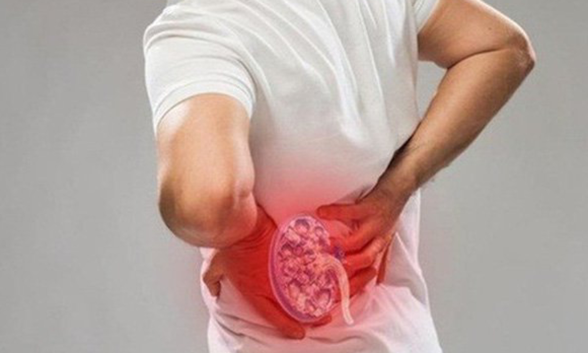 Quiz: Nguy cơ mắc bệnh thận của bạn thế nào?
