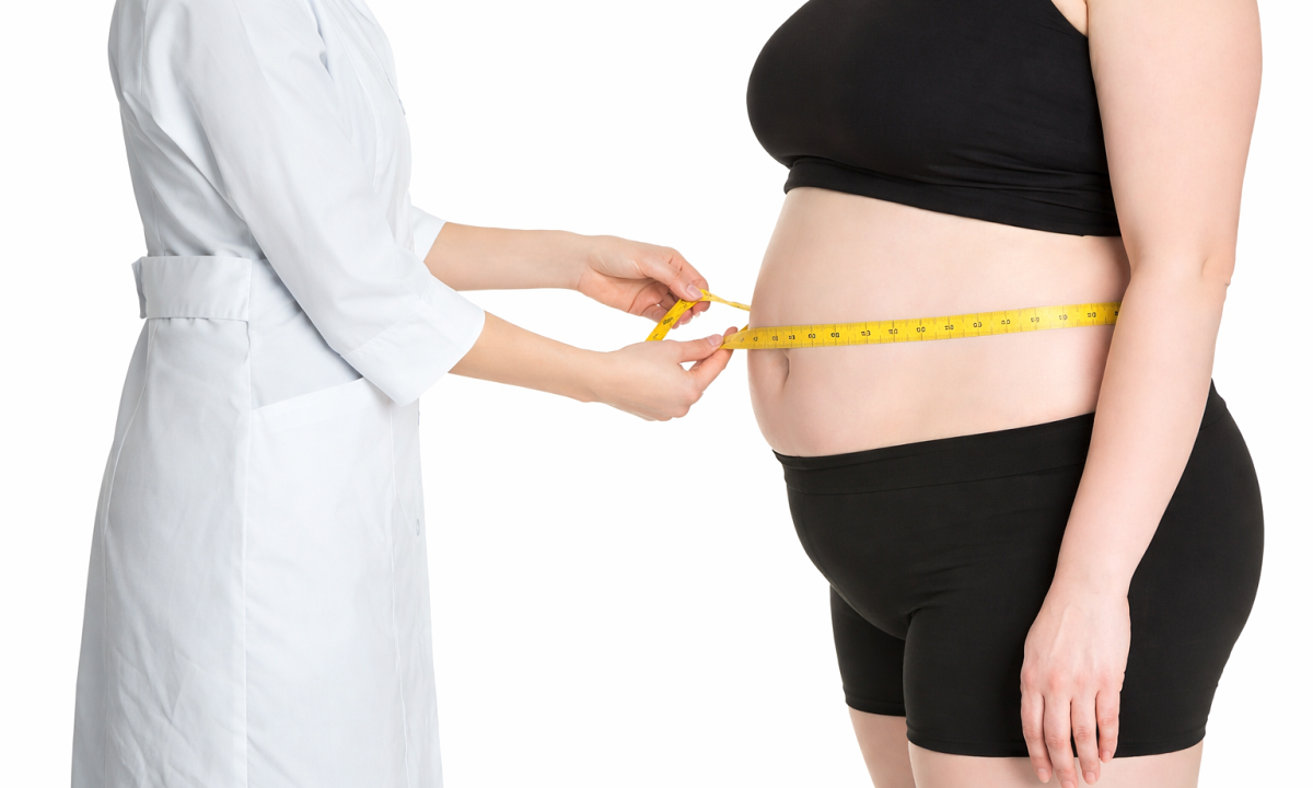 Chuyên gia chỉ ra 3 kiểu béo phì và cách giảm mỡ hiệu quả