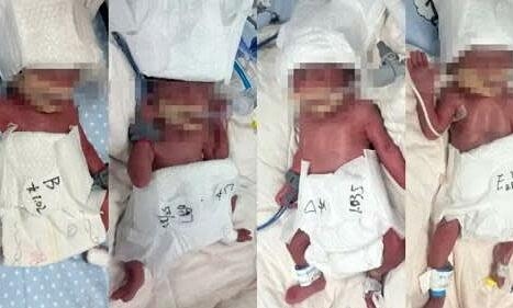 Sản phụ 24 tuổi sinh 5 con sau thụ thai tự nhiên