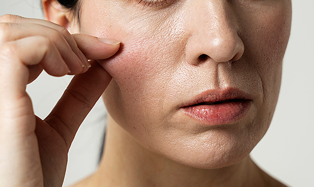 5 thói quen hàng ngày khiến collagen 'bốc hơi' nhanh hơn bạn tưởng